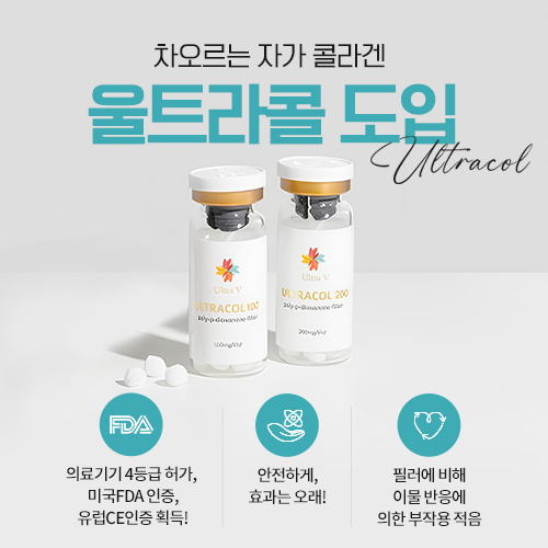 울트라콜